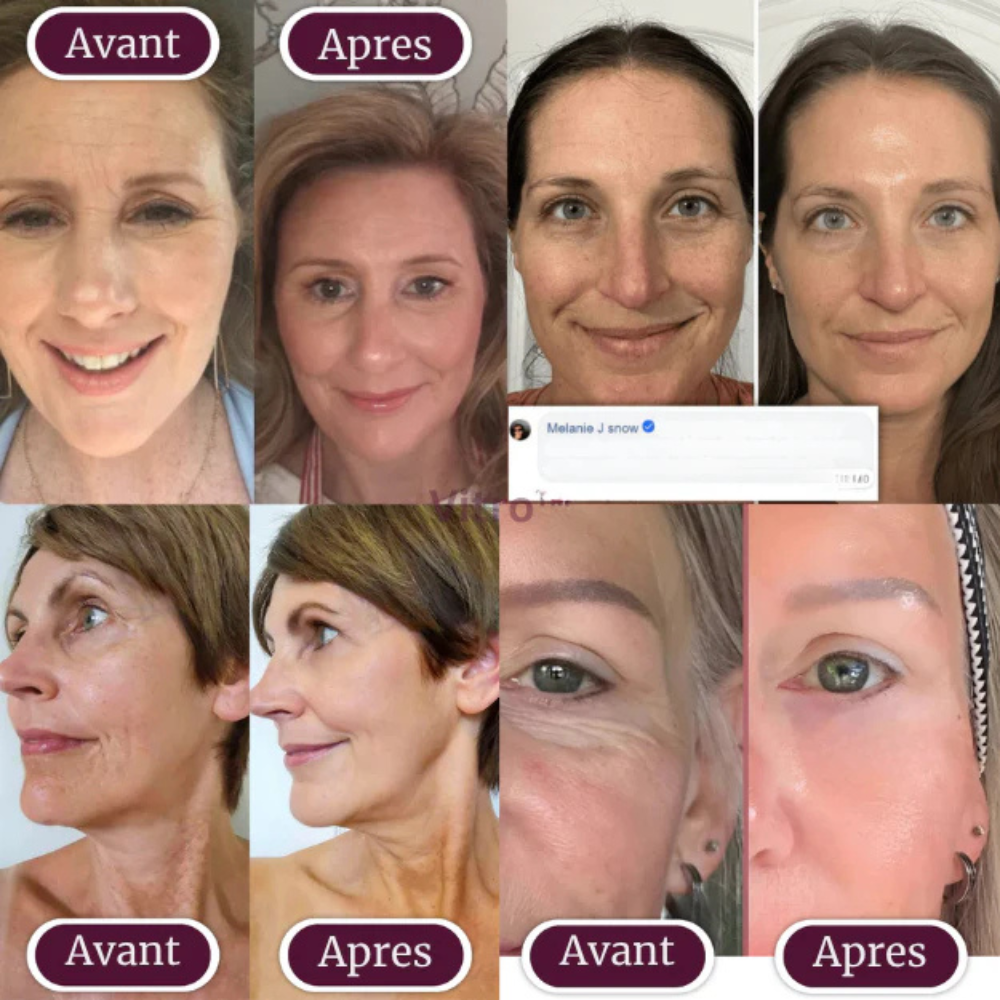 Baume anti cerne au collagène et calcium